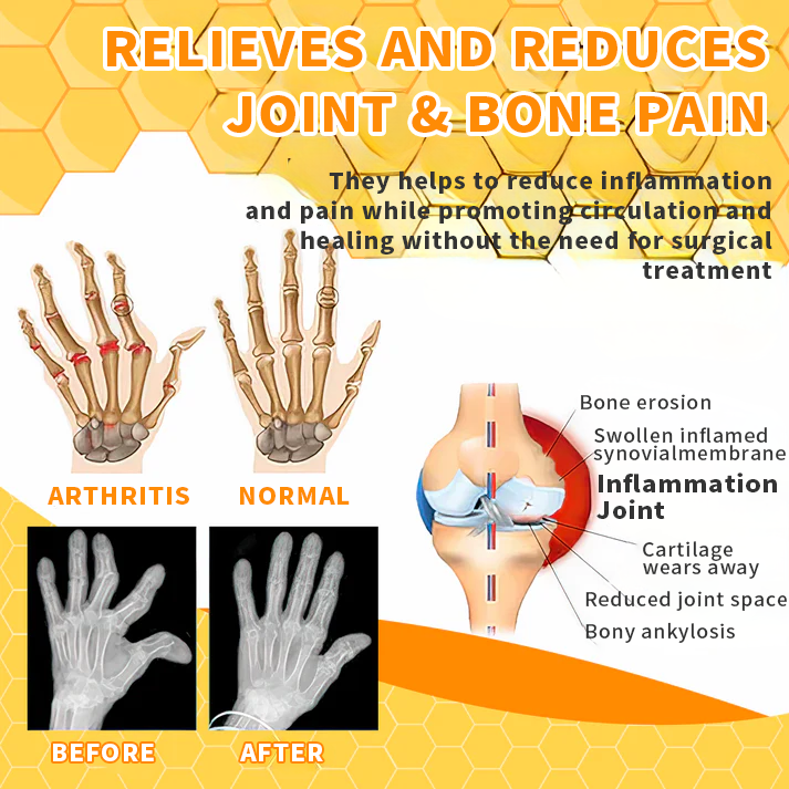 🐝Seurico™  Bee Venom Joint Therapy Pain Relief Gel