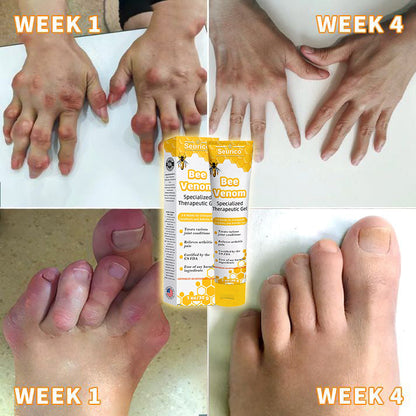 🐝Seurico™  Bee Venom Joint Therapy Pain Relief Gel