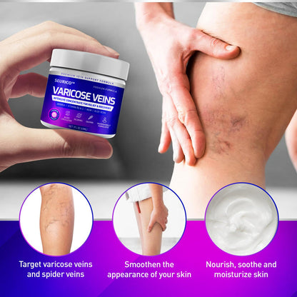 Seurico™ Varicose & Spider Veins Soothing Leg Cream